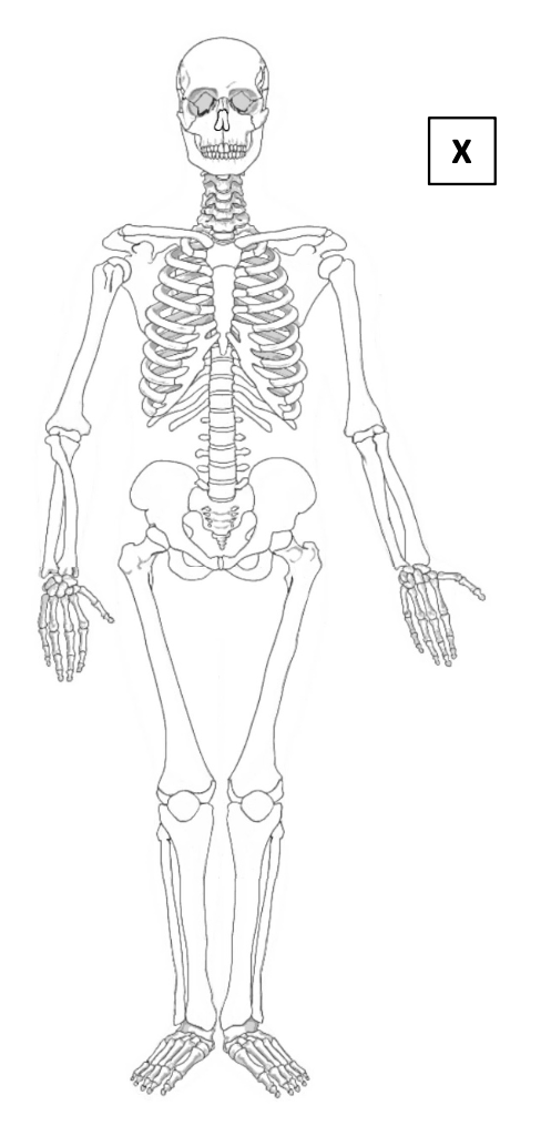 Human skeleton (front view) — skull, vertebral column, ribs, pelvis, limbs, with X box on the right