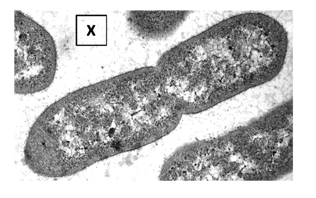 TEM image of a rod-shaped bacterial cell, with X box marking position of cell wall