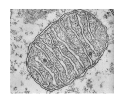 TS through a mitochondrion — outer membrane and folded inner membrane (cristae)