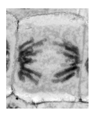 Stage of mitosis in an onion cell — chromosomes being pulled to opposite poles (anaphase)