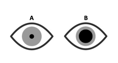 Two eyes labelled A and B — pupil sizes differ to show light-level adaptation
